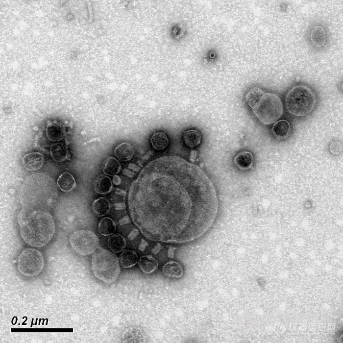 【原创大赛】噬菌体透镜照片