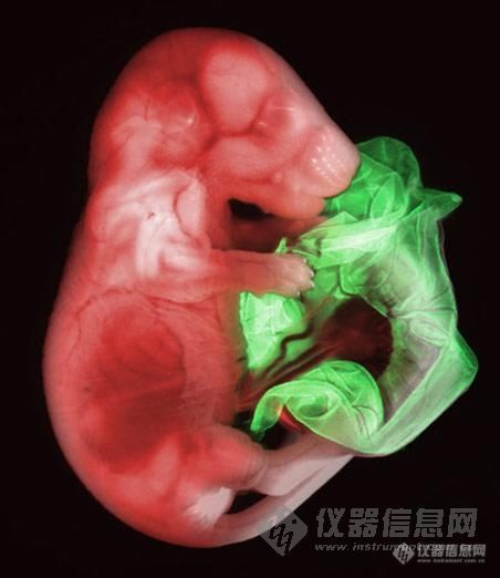 【转帖】2007年最佳显微照片 转基因老鼠胚胎居首