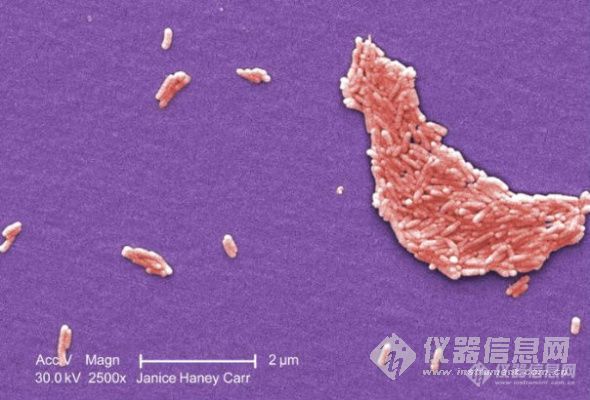 【分享】危险之美：显微镜下的致命病菌和病毒(组图)