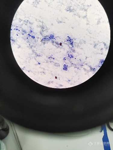 二甲苯胺蓝染色液染色酵母