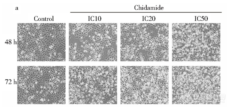 显微镜下西达本胺影响HCT-15细胞形态