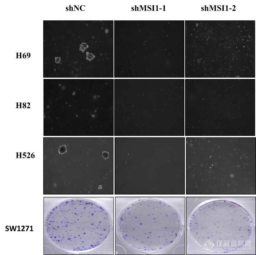 光学显微镜下克隆实验表征MSI1 低表达对H82的增殖具有抑制作用