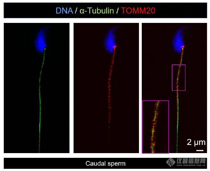「翘客」技术手册:探索生命起源的微观骨架——微管蛋白抗体在精子发生机制研究中的免疫荧光染色应用_仪器信息网社区